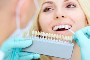 dentist helping patient pick out a porcelain veneer shade